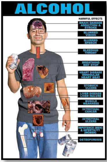 Alcohol Throat Irritation 26